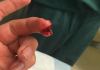 So My Friend Cut His Finger On A Band Saw. Check Out The Pics.